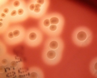 colonies with beta-hemolysis
