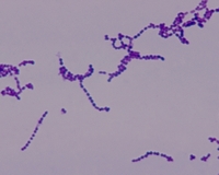 stroptococcus Gram stain