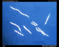 borrelia darkfield microscopy