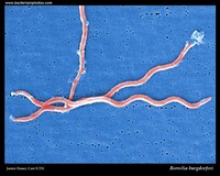 borrelia SEM image