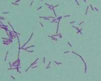 Gram stained cells of legionella
