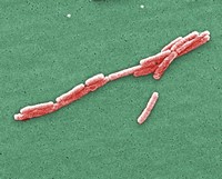 Legionella SEM