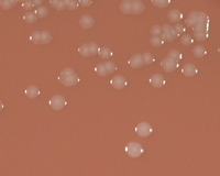 colonies of Neisseria gonorrhoeae on modif. chocolate agar