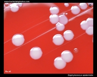 colonies on blood agar