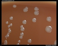 colonies on chocolate agar