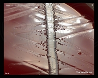 Haemophilus influenzae satelliting around Staphylococcus aureus