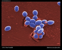 enterococcus faecalis SEM