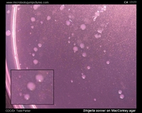shigella colonies