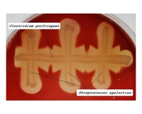 clostridium perfringens CAMP test