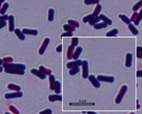 clostridium perfringens
