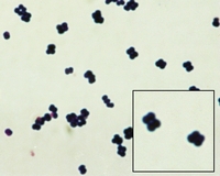Micrococcus luteus Gram stain