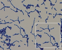 s.agalactiae gram stain
