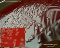 listeria growing on PALCAM