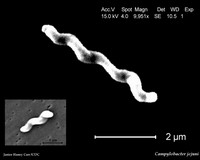 Campylobacter jejuni SEM