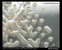 Bacillus anthracis mucoid colonies on agar