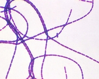 b.anthracis gram stain