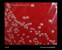 colonies on agar with blood