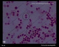 gram stain, gram negative diplococci