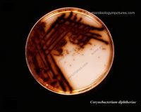 colonies on agar