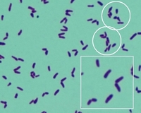 gram stain, gram-positive club-shaped rods