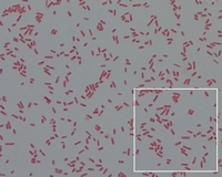 Gram-stained salmonella cells