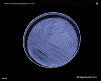 B.pertussis Gram stain