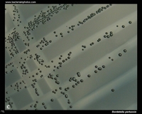 Bordetella pertussis