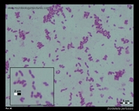 Bordetella pertussis Gram stain