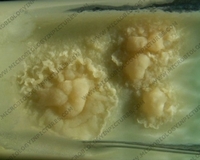 mycobacterium tuberculosis colonies