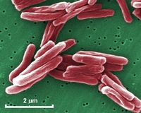 mycobacterium tuberculosis SEM micrograph