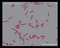P.aeruginosa Gram stain