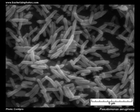 P.aeruginosa SEM micrograph