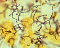 t.pallidum