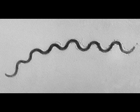 treponema pallidum SEM