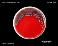 y.pestis on blood agar
