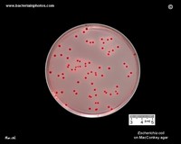 colonies of e.coli