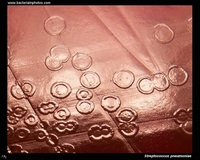 streptococcus pneumoniae on blood agar