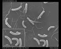 vibrio cholerae SEM