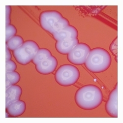 Colonies with a slight umbonate center colonies with umbonate center