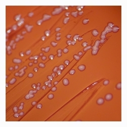 Small-colony phenotype: tiny (1–2 mm) colonies small-colony phenotype, nonhemolytic, nonpigmented colonies