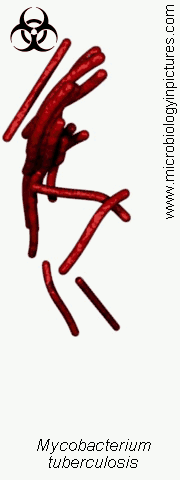 mycobacterium tuberculosis