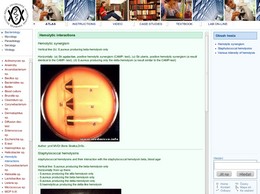 http://atlas.medmicro.info/ medmicro