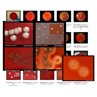 cultivation media in microbiology