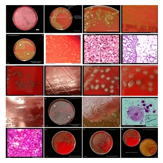 alpha hemolytic streptococci and pneumococci