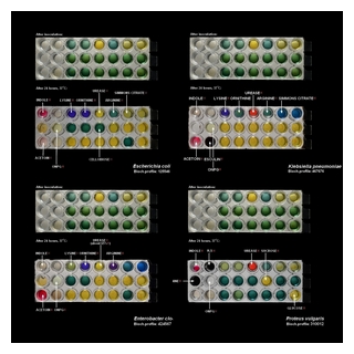exammples of the biochemical identification of bacteria
