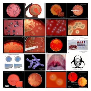 beta-hemolytic streptococci