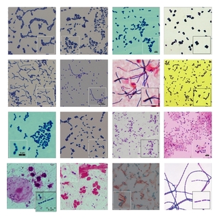 micrographs