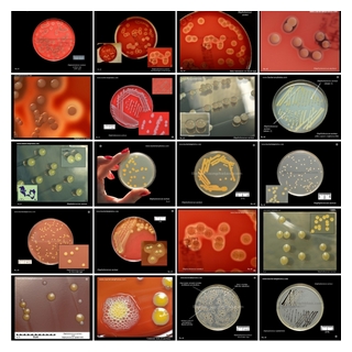 staphylococci