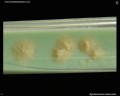 mycobacterium tuberculosis on L�wenstein-Jensen medium