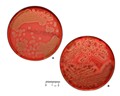 s. aureus on agar